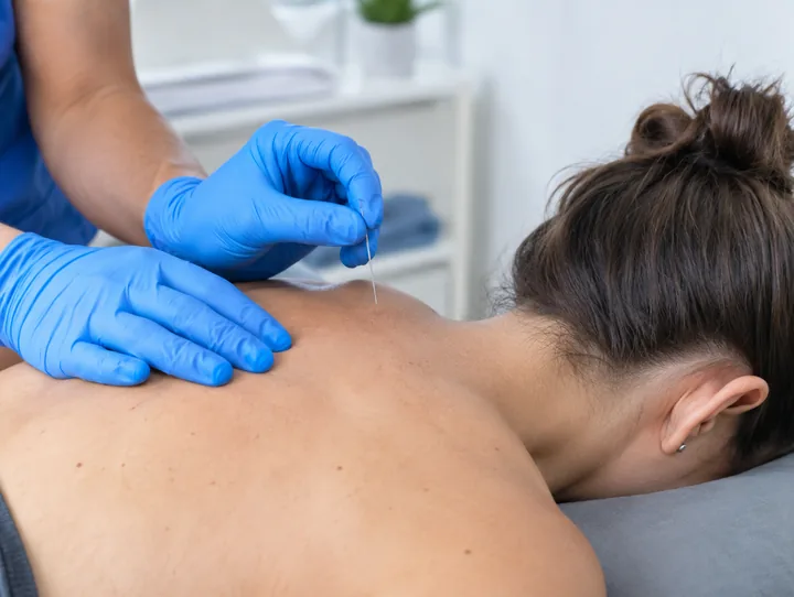 Dry needling van de schouderspier